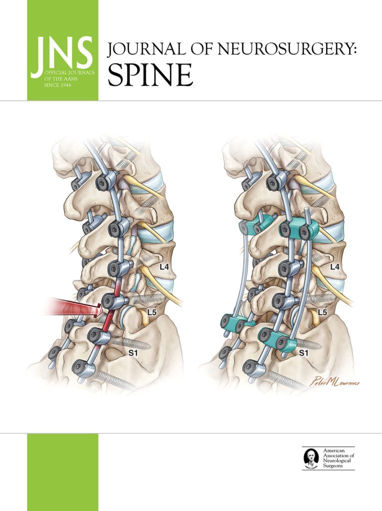 Images of the spine with pedicle screws