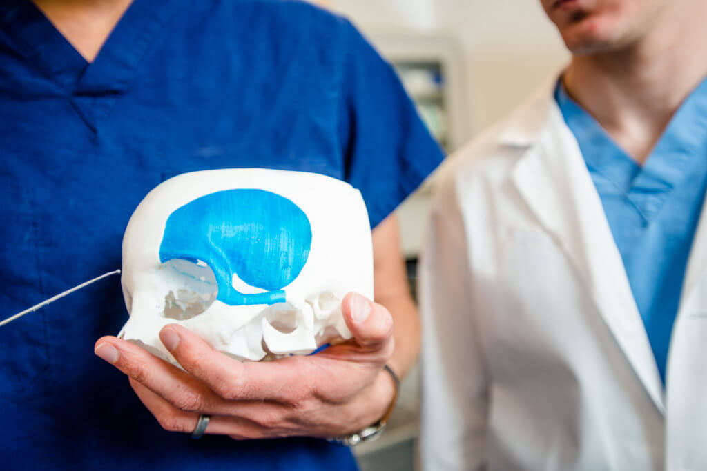 Medical professionals holding a 3d printed model of a skull