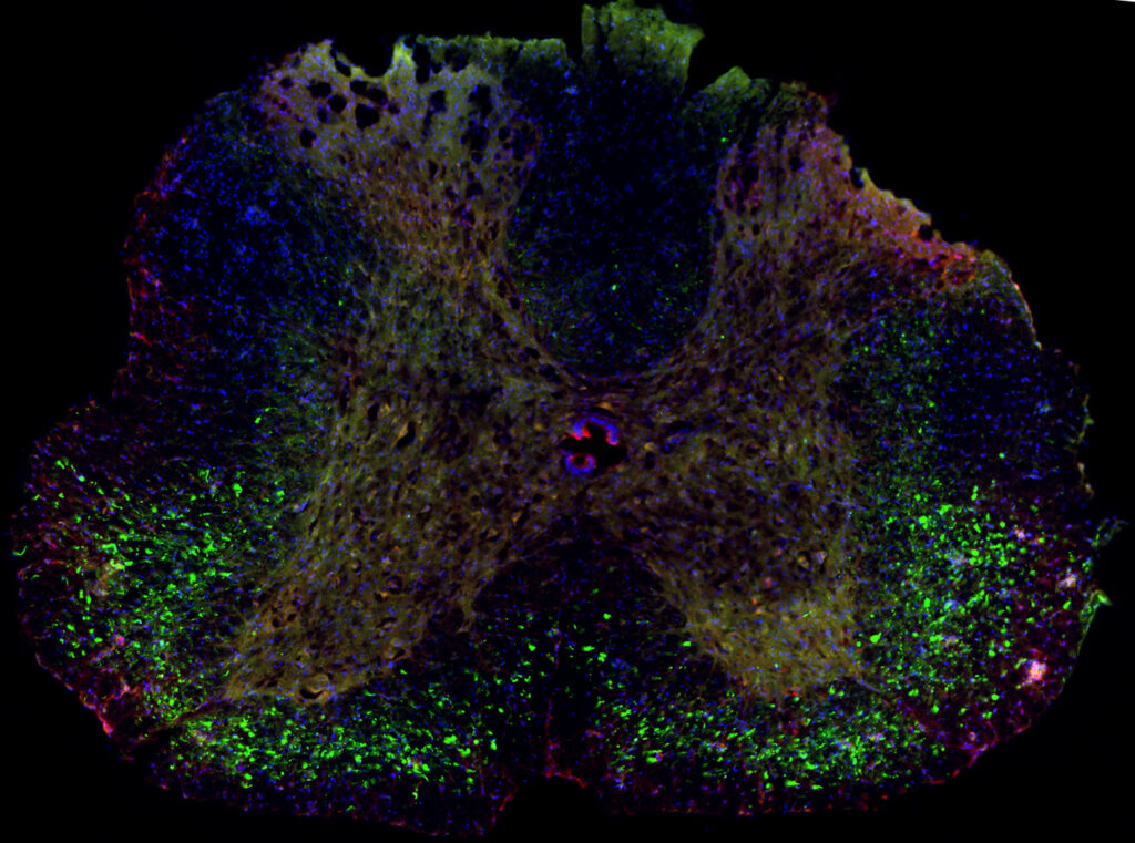 Spinal cord transduction following subpial AAV delivery