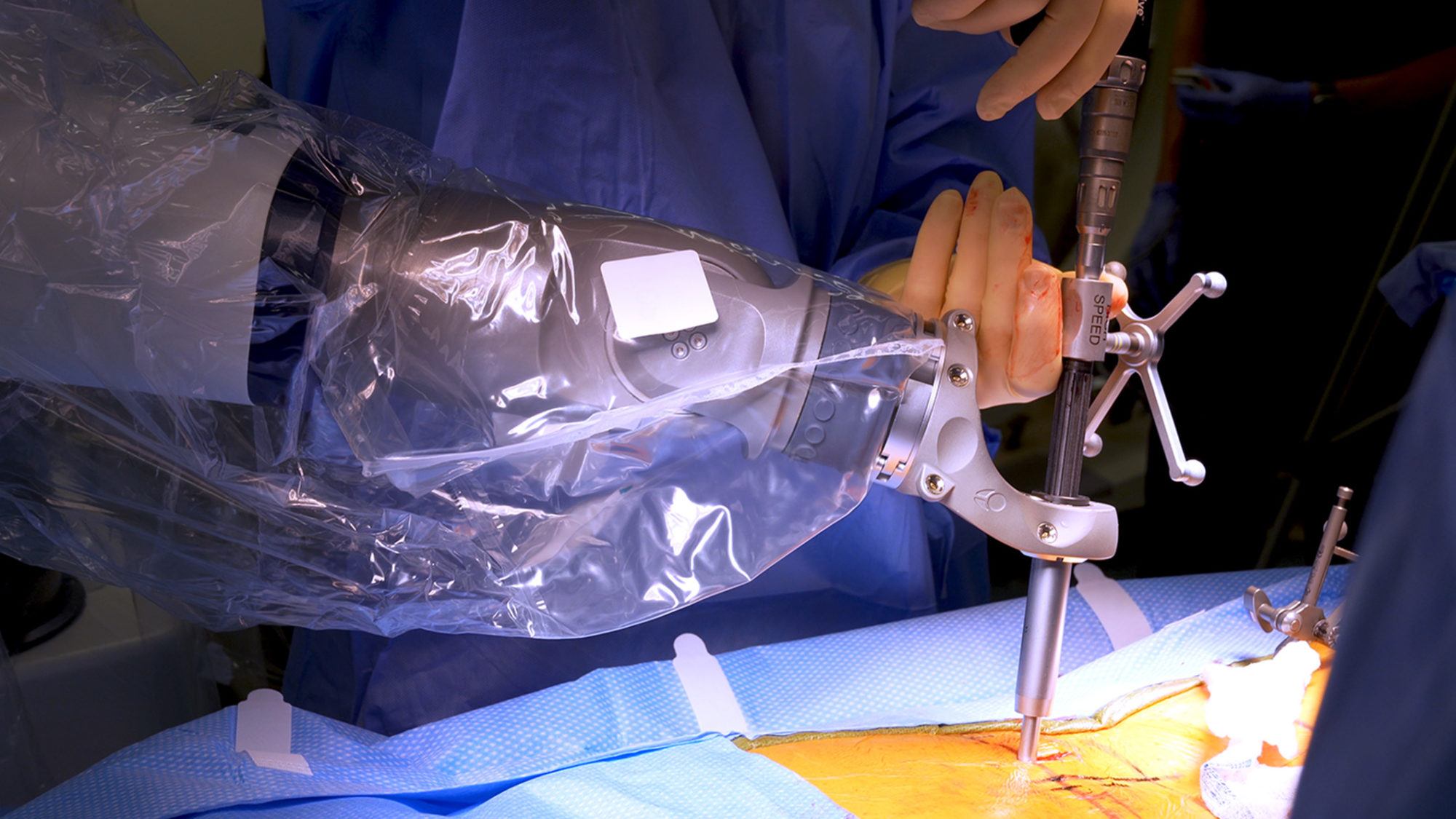 dr. david barranco performing robotic spine surgery