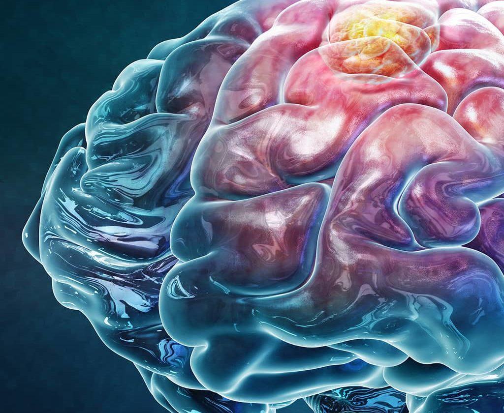 illustration of a brain tumor