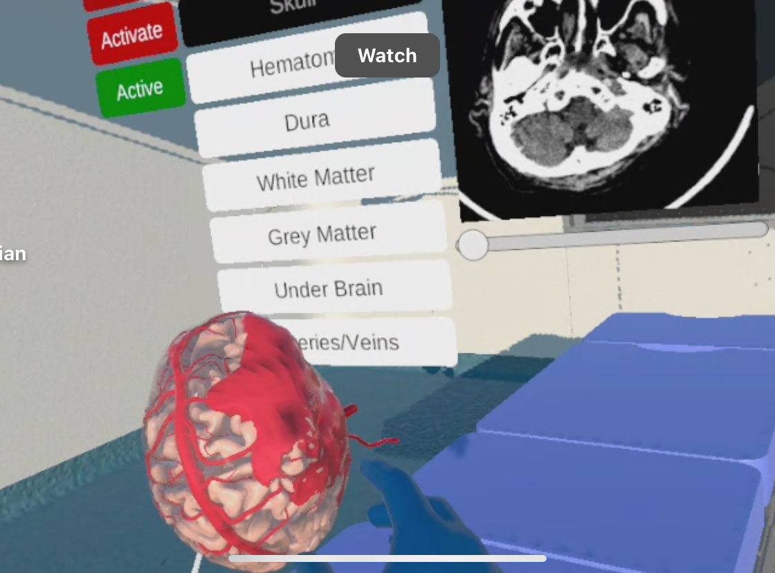 A screen shot from a virtual reality system for neurosurgery education
