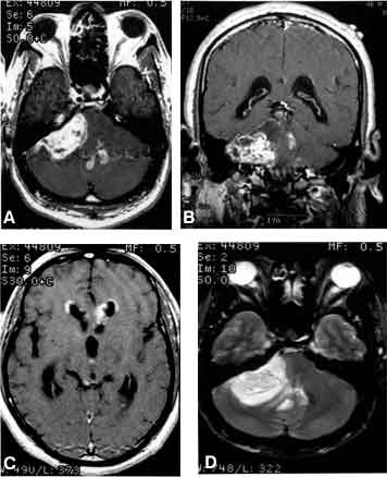 Figure 1. (A) Axial and (B) coronal T1-weighted MR images