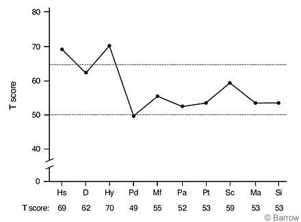 Figure 1. MMPI-2 profile of a 51-year-old woman with memory complaints