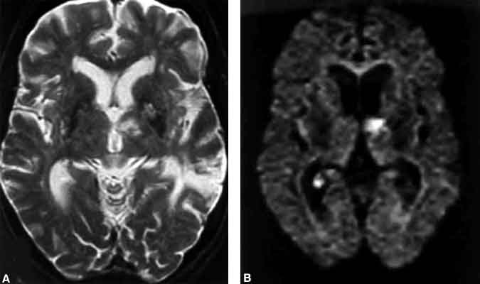 Figure 10. An 87-year-old woman presented with the acute onset of confusion.