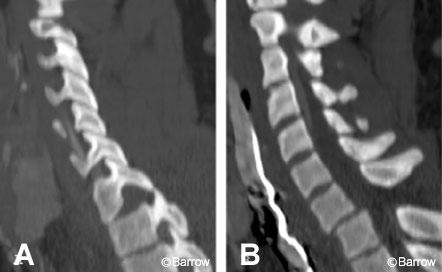 Figure 13. Sagittal computed tomography scans