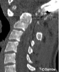 Figure 18. Sagittal computed tomographic scan