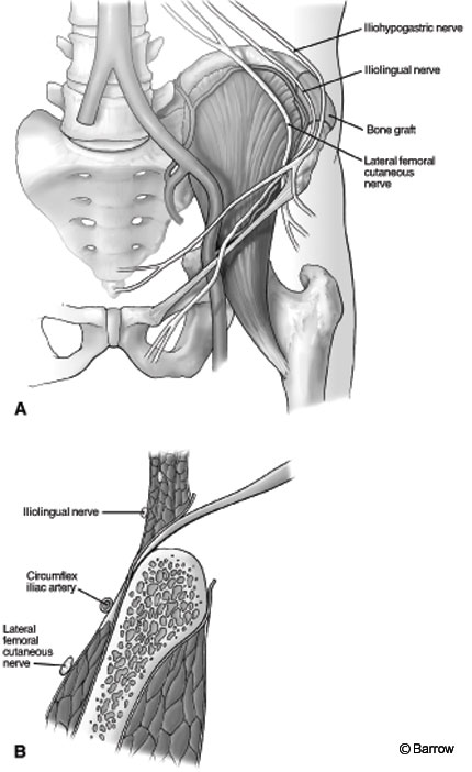 Figure 2. (A) Anterior view of graft site