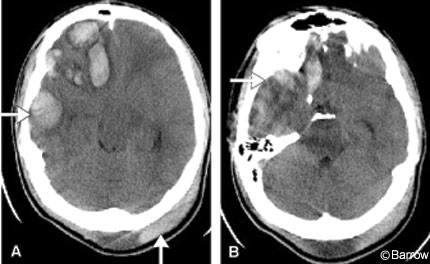 Figure 2. Axial computed tomographic scans
