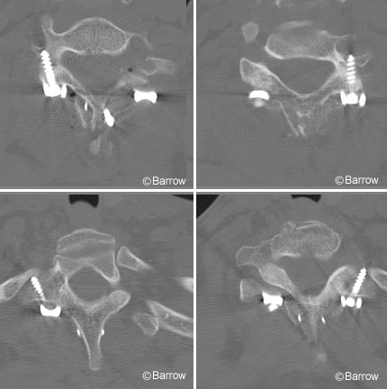 Figure 2. Axial computed tomographic scans
