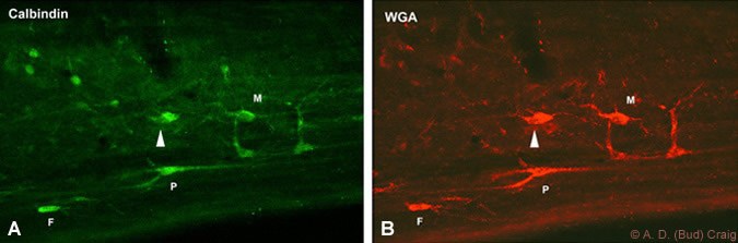Figure 2. Spinal neurons