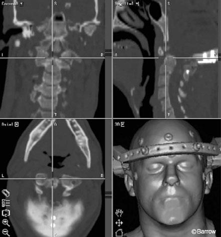 Figure 20. StealthStation images