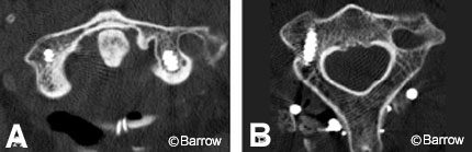 Figure 24. Postoperative axial computed tomographic scans
