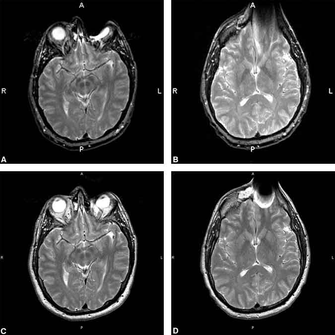 Figure 4. Axial conventional spin-echo images