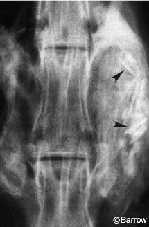Figure 4. Rabbit spine fusion with rhBMP-2 at 5 weeks
