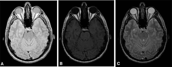 Figure 5. MR Images