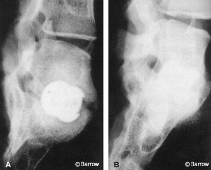 Figure 6. Lateral radiographs of rhesus lumbosacral spines