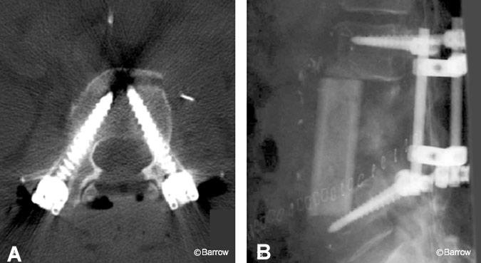 Figure 7. (A) Axial computed tomographic scan