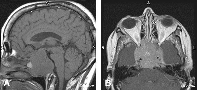 Figure 8. (A) Sagittal precontrast T1-weighted image
