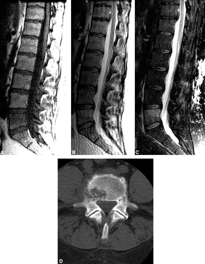 TSE/FSE - Questions and Answers ​in MRI