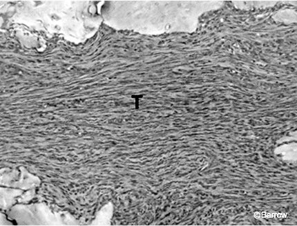Figure 9. Ectopic tendon formation using cartilage-derived morphogenetic proteins