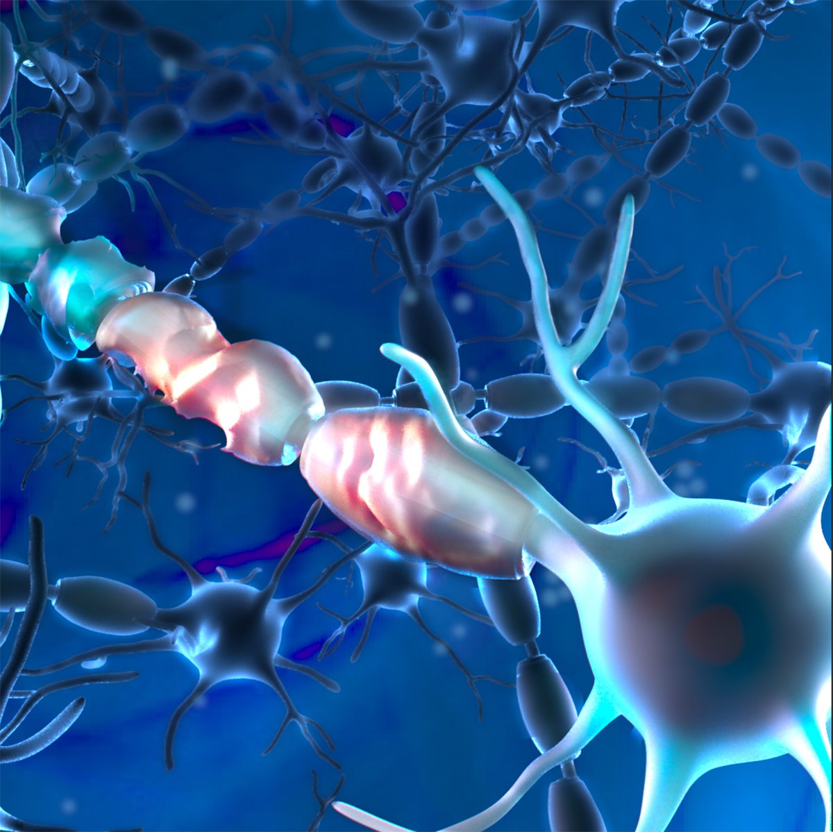 Damage to neurons from ALS