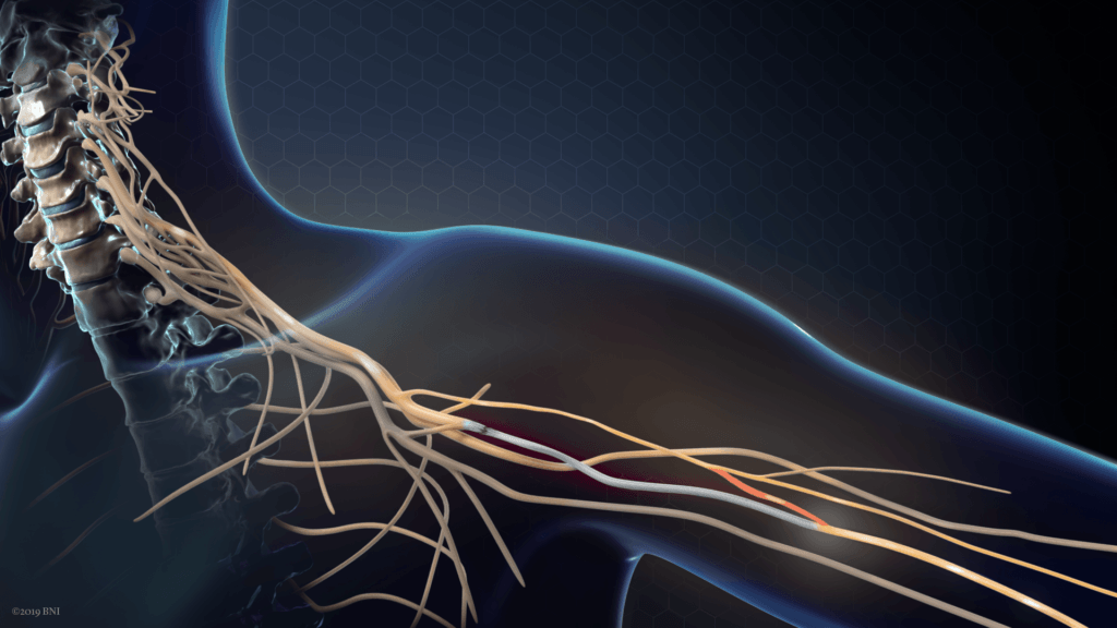Nerve Transfer Surgery: Reanimating the Hand After Spinal Cord Injury ...