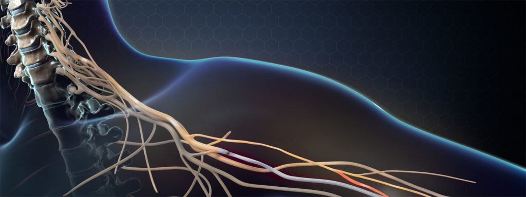 nerve transfer surgery used for hand reanimation