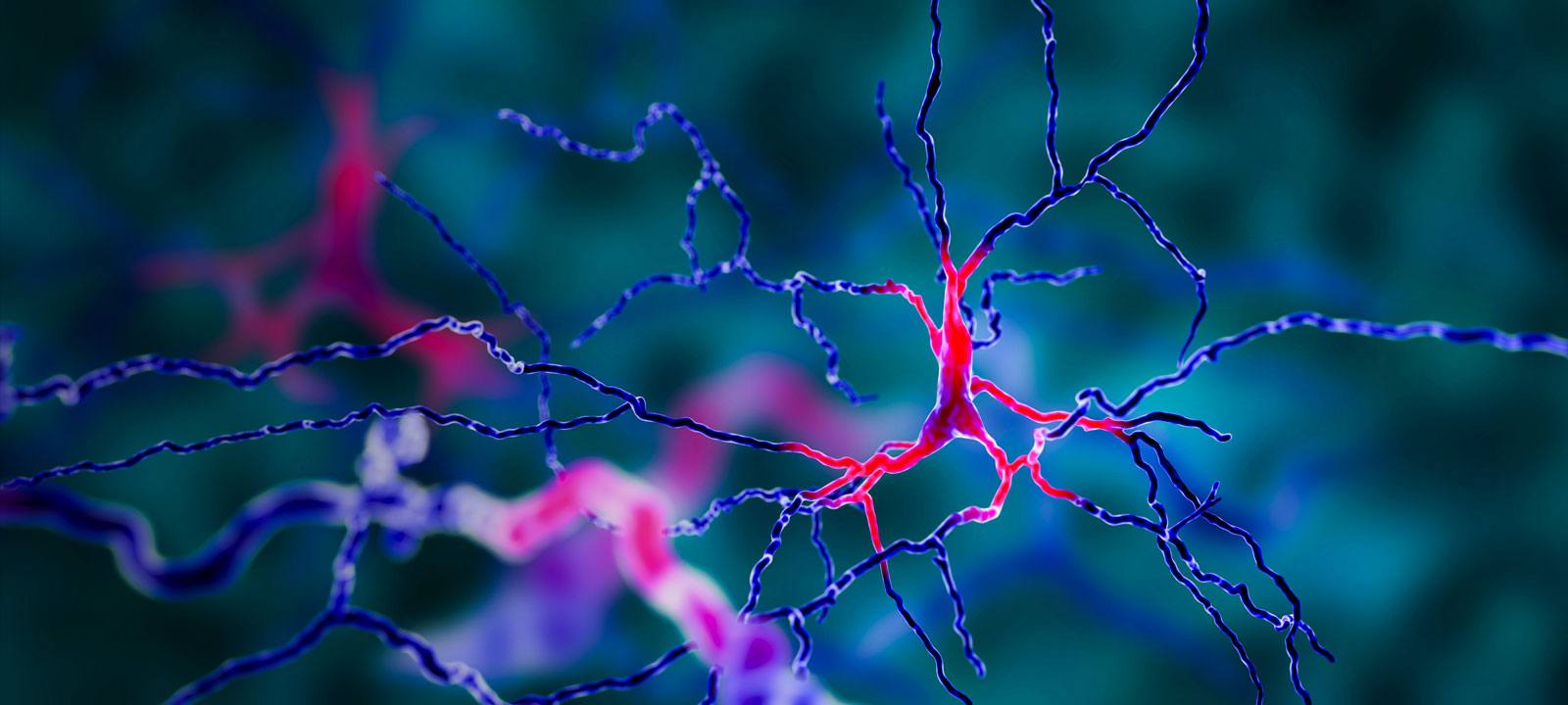 parkinson's disease neurons