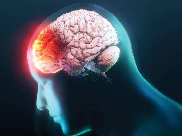 illustration of a traumatic brain injury