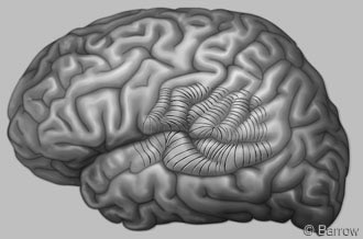Figure 5. Brain model depicting subpial transections.