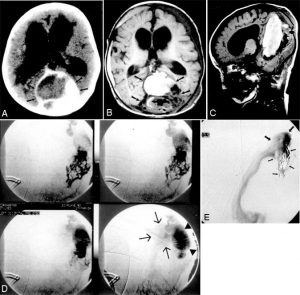 Malformations in Infants Figure 1