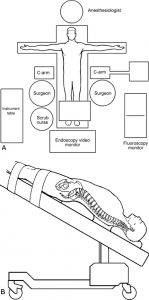The Laparoscopic Approach for Instrumentation and Fusion of the Lumbar Spine Figure 1