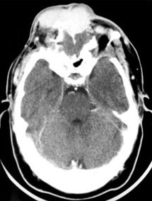 Axial computed tomography scan