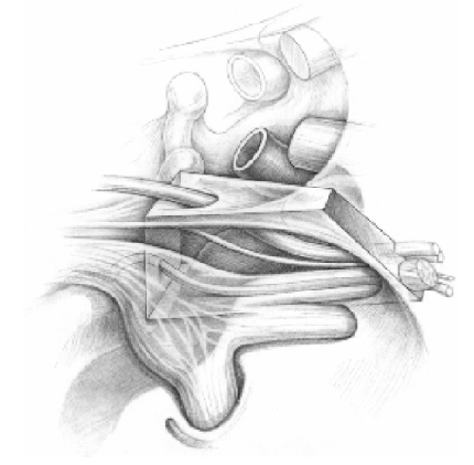 Orbital Lesions figure 1 image