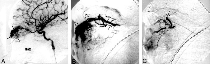 Orbital Lesions Figure 2