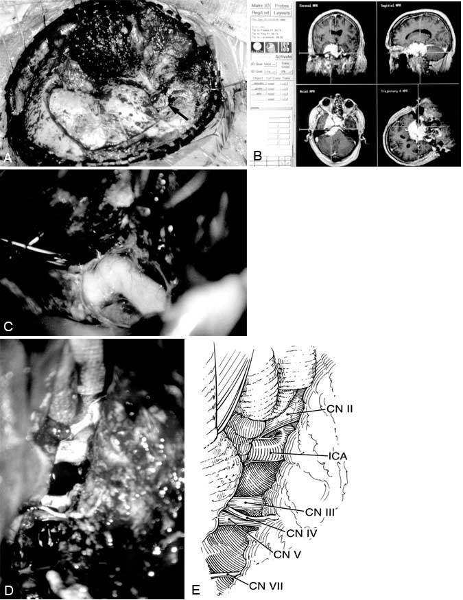 X-rays