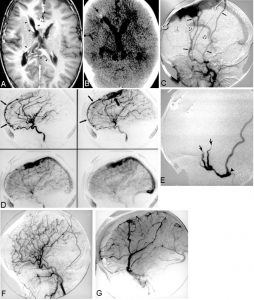 Malformations in Infants Figure 2