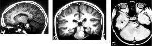 axial magnetic resonance images