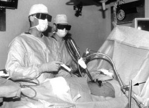 Thoracoscopic Approaches for the Treatment of Anterior Thoracic Spinal Pathology Figure 3