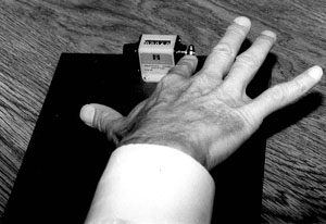Finger Tapping and Brain Dysfunction: A Qualitative and Quantitative Study Figure 3