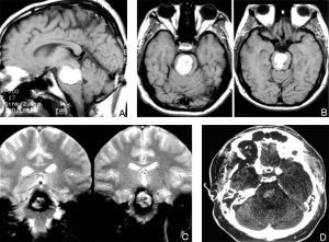 Sagittal