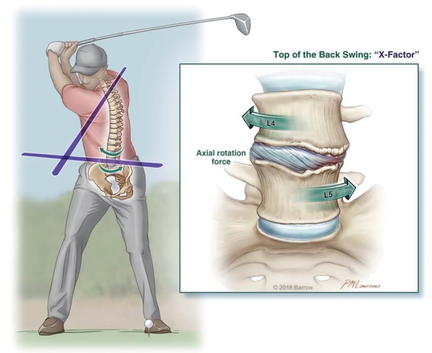 Golf spine illustration