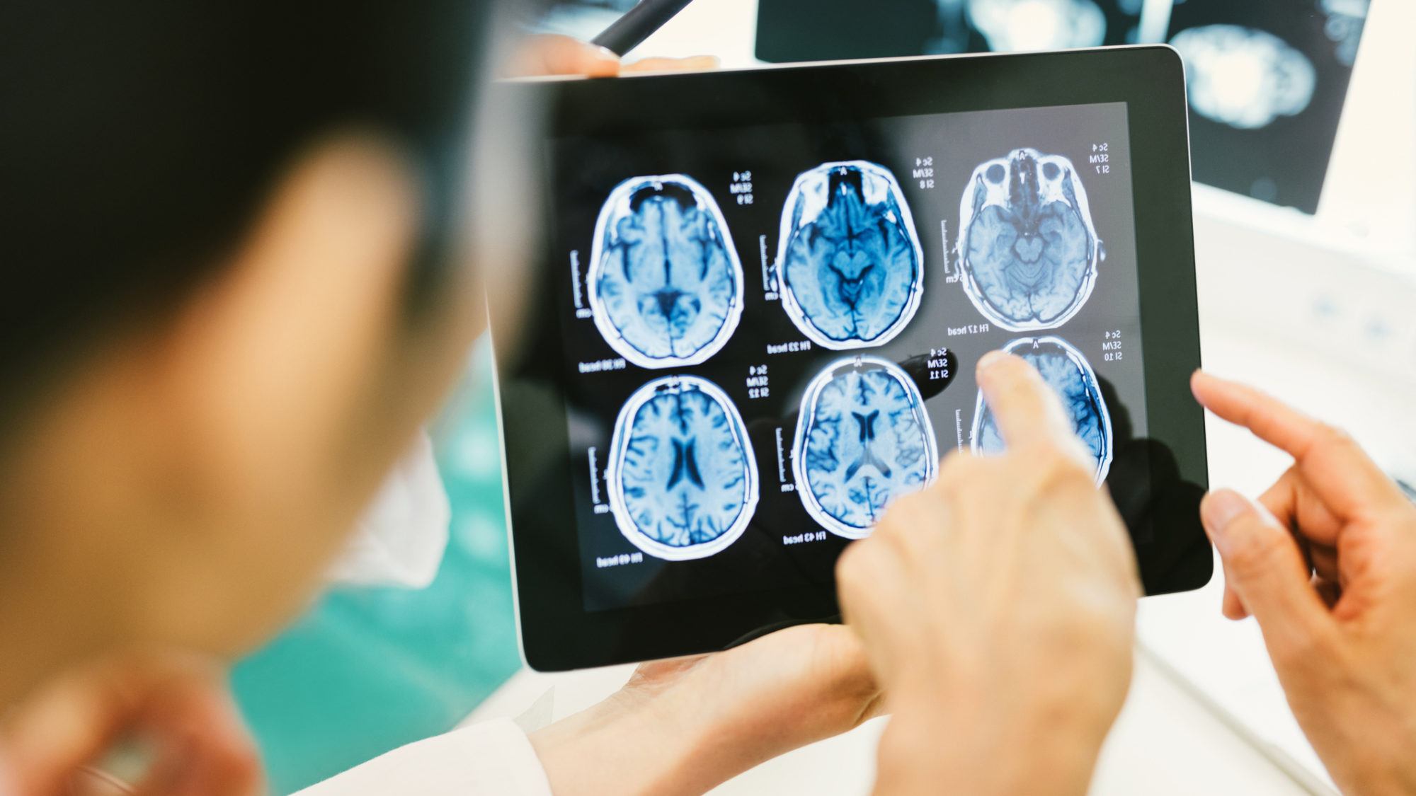 doctor analyzing brain scans on a digital tablet