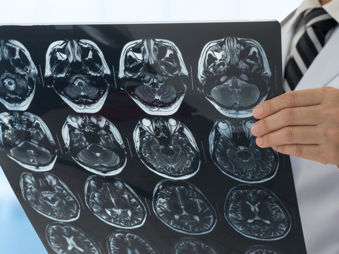 doctor analyzing brain scans