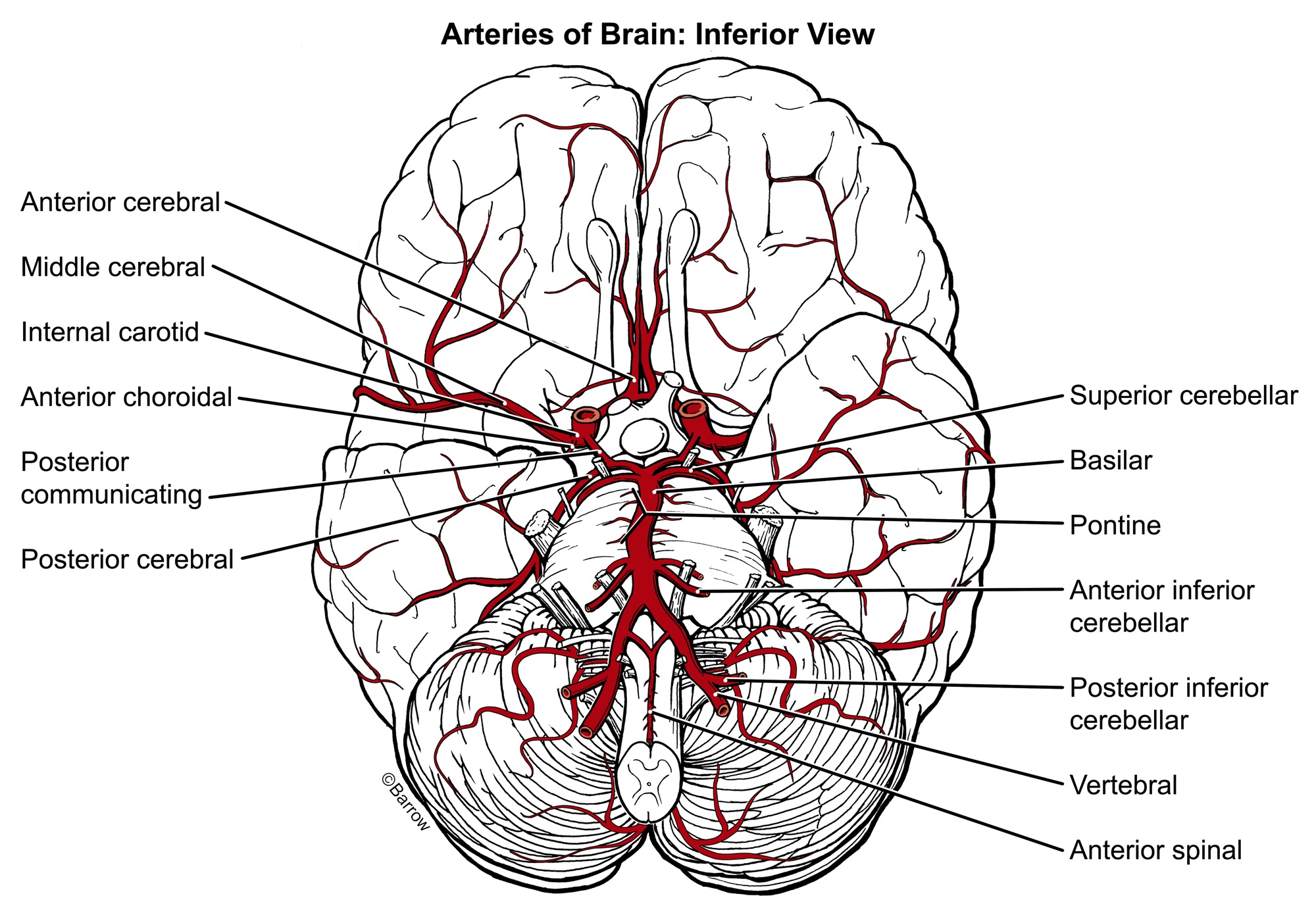 How aware are you? - Brain Aneurysm Awareness Quiz - Brain Aneurysm  Foundation