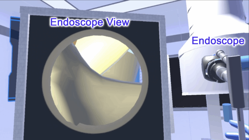 Still image from the endoscopic spine surgery simulator