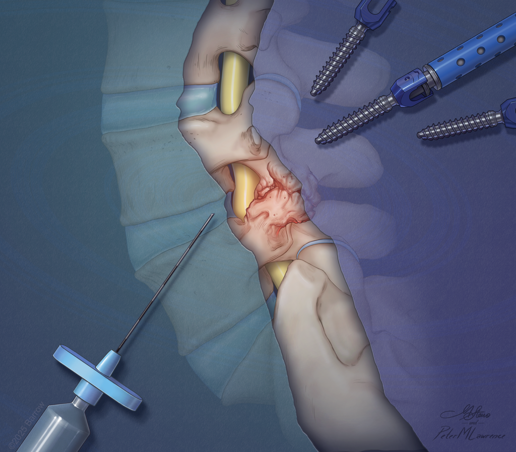 Illustration depicting pain management procedures, including nerve blocks, and instrumentation of the spine.