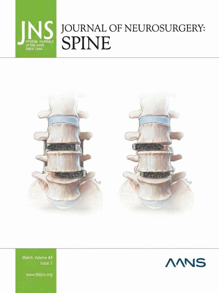 Side-by-side illustrations depicting cage migration after spinal surgery