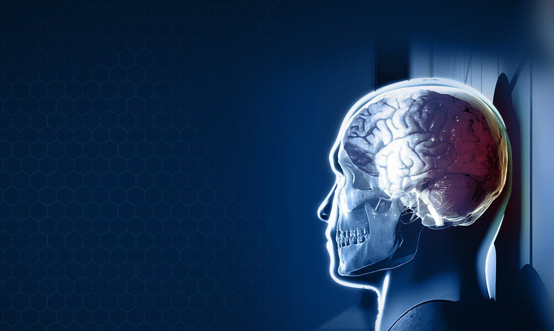 xray 3d image showing a brain undergoing concussion